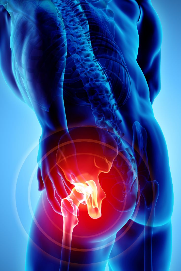 Hip Pain Relief and Treatment