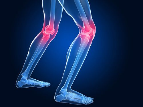 Knee Arthritis Relief and Treatment