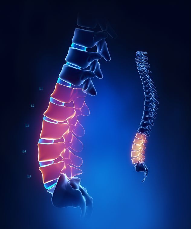 Spinal Stenosis Relief and Treatment